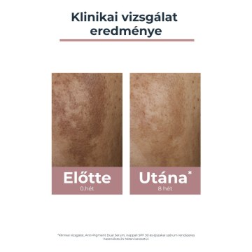 Alternative view of Eucerin Anti-Pigment arckrém éjszakai 50 ml