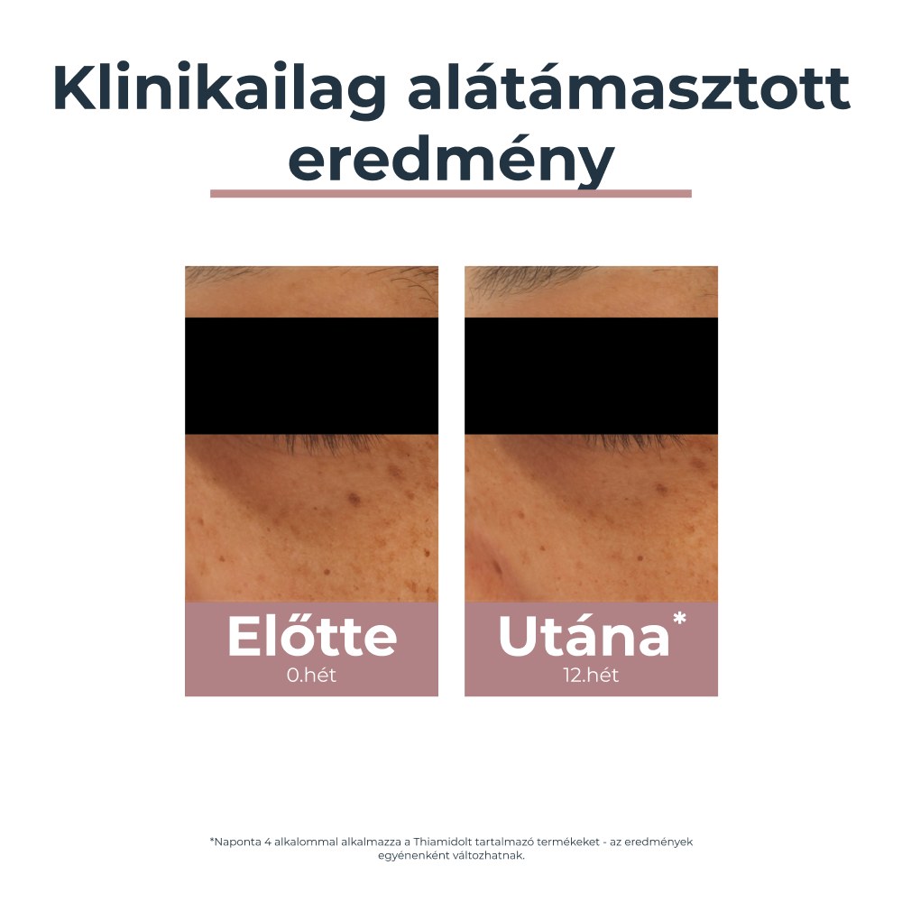 Eucerin Anti-Pigment szemránckrém 15 ml - Image 5