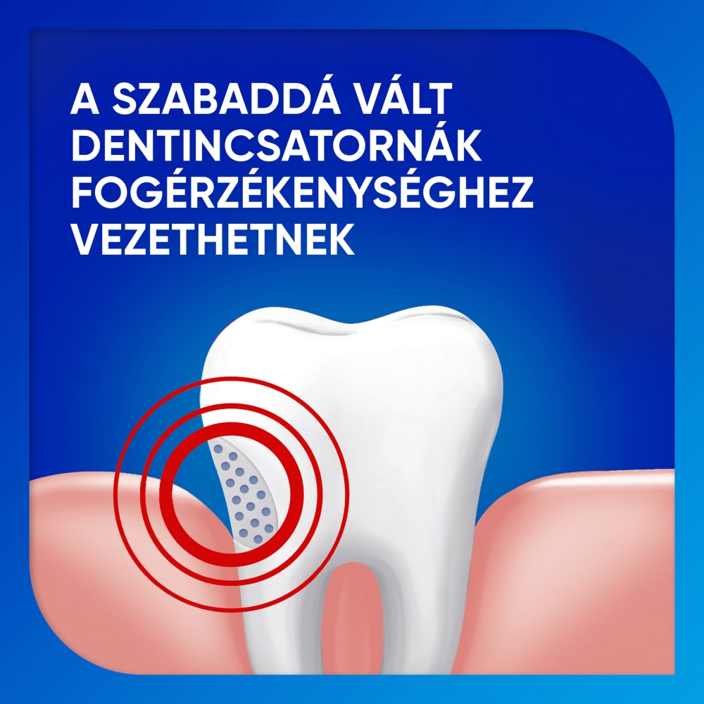 Sensodyne Extra Fresh fogkrém 75 ml - Image 3